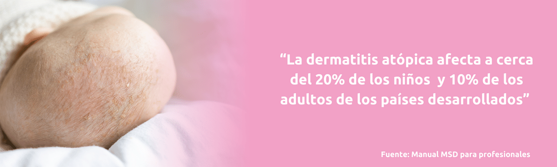 dermatitis atópica en el cuero cabelludo