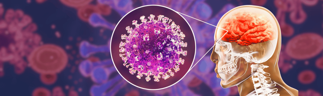 Virus Nipah 