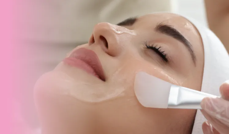 exfoliación química